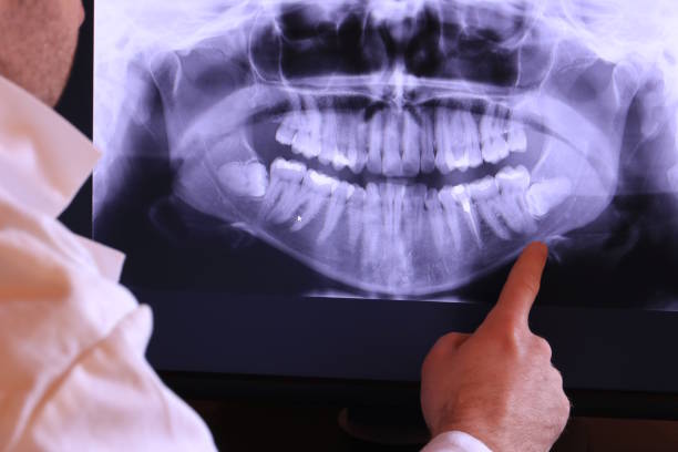 Best Dentist for Tooth Abscess  in Armada, MI
