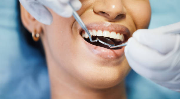 Best Chipped Tooth Repair Near Me  in Armada, MI